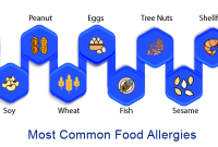 What Are The Most Common Food Allergies