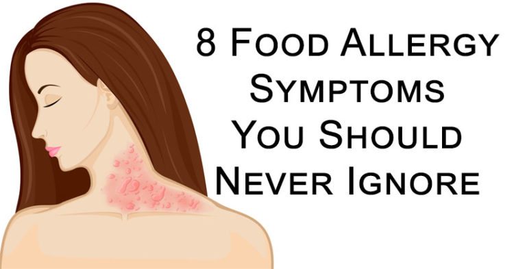How To Recognize Symptoms Of Food Allergies